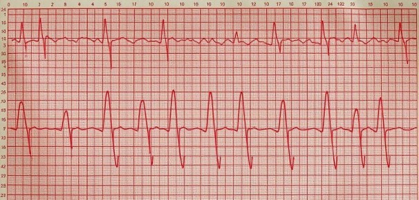 Как распознать ипохондрию и вернуть спокойствие